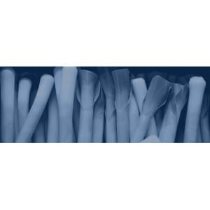 Transplantadoras de puerros